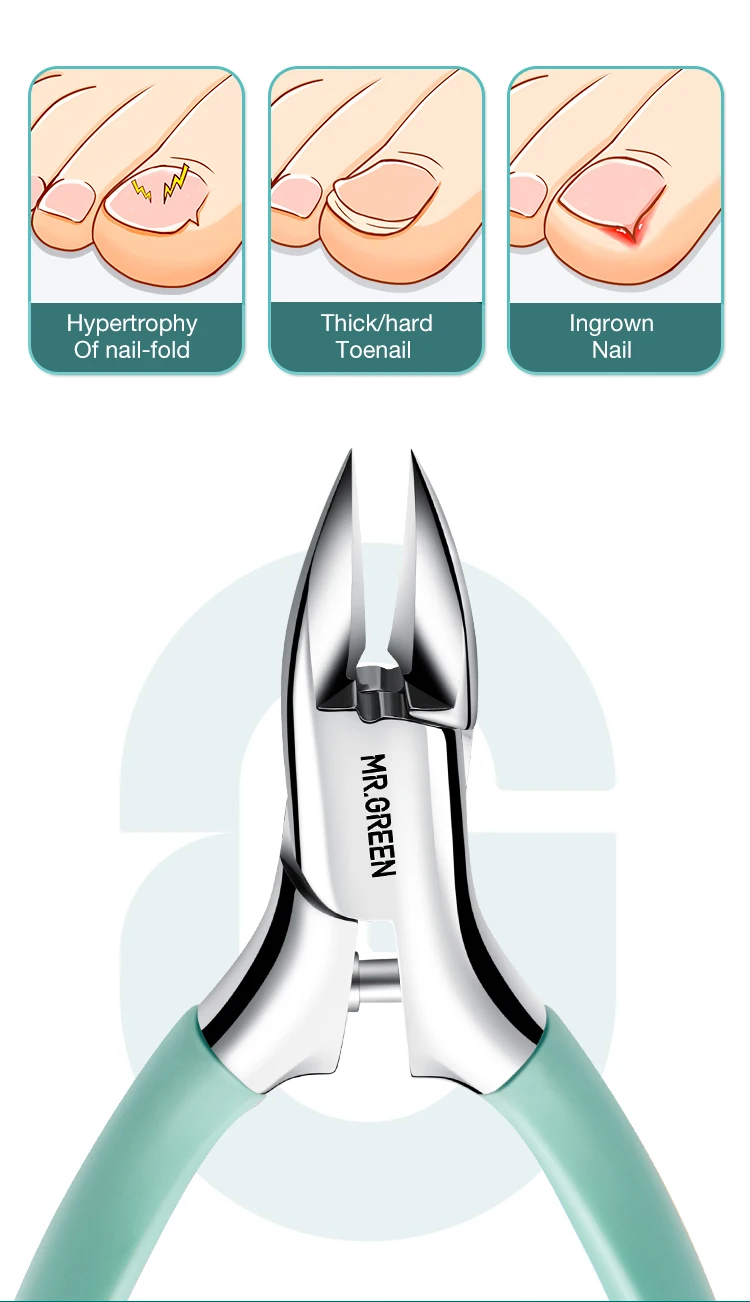 MR.GREEN Toenail Clippers Professional Pedicure Tool Nail Clippers Anti-Splash Ingrown Olecranon Cutters Manicure Tools Sets