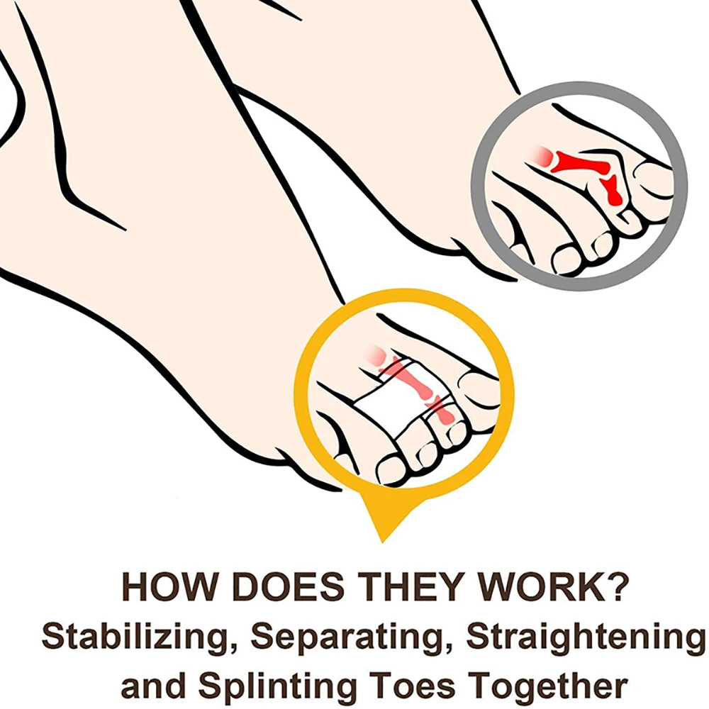 Pexmen 1/2/5/10Pcs Hammer Toe Straightener Toe Splints Cushions Bandages for ProtectorCrooked & Overlapping Toes Protector