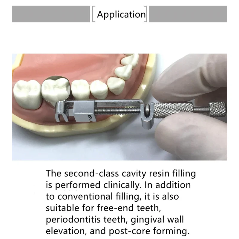20Pcs Dental Matrix Bands Tofflemire Stuck Gingival Wall Lift Large Curvature Sectional Contoured Matrices Matrix Dentistry Tool