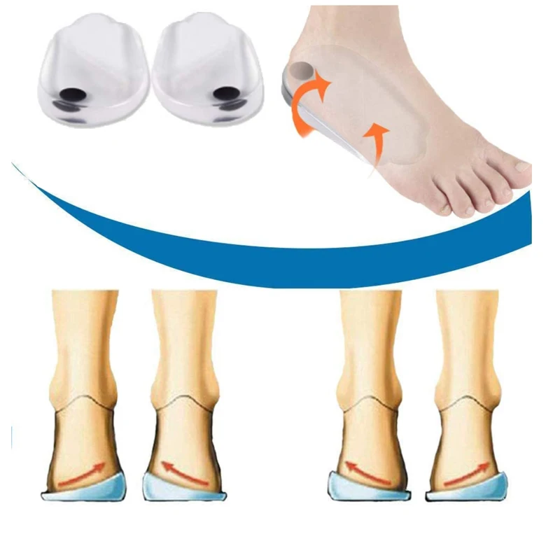 Magnetic Silicone Orthopedic Insoles for Shoes Men Women Plantar Fasciitis Relief O/X Legs Knee Varus Correction Feet Heel Pads