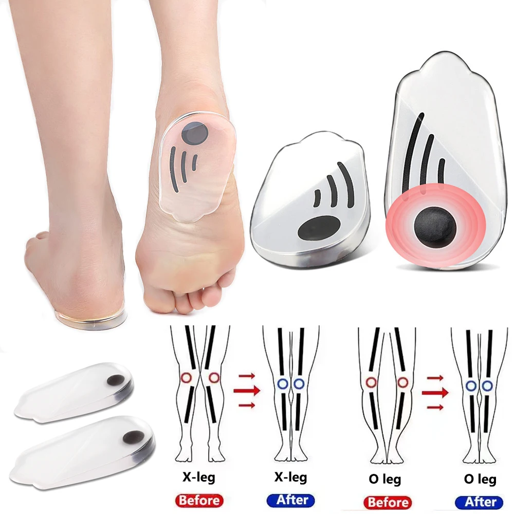 Magnetic Silicone Orthopedic Insoles for Shoes Men Women Plantar Fasciitis Relief O/X Legs Knee Varus Correction Feet Heel Pads