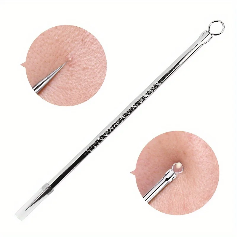 Stainless Steel Blackhead Remover, Pimple Popper Tool for Blemish, Whitehead, Acne Removal, Suitable for Normal Skin