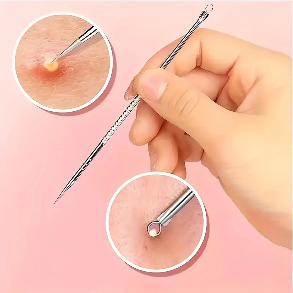 Stainless Steel Blackhead Remover, Pimple Popper Tool for Blemish, Whitehead, Acne Removal, Suitable for Normal Skin