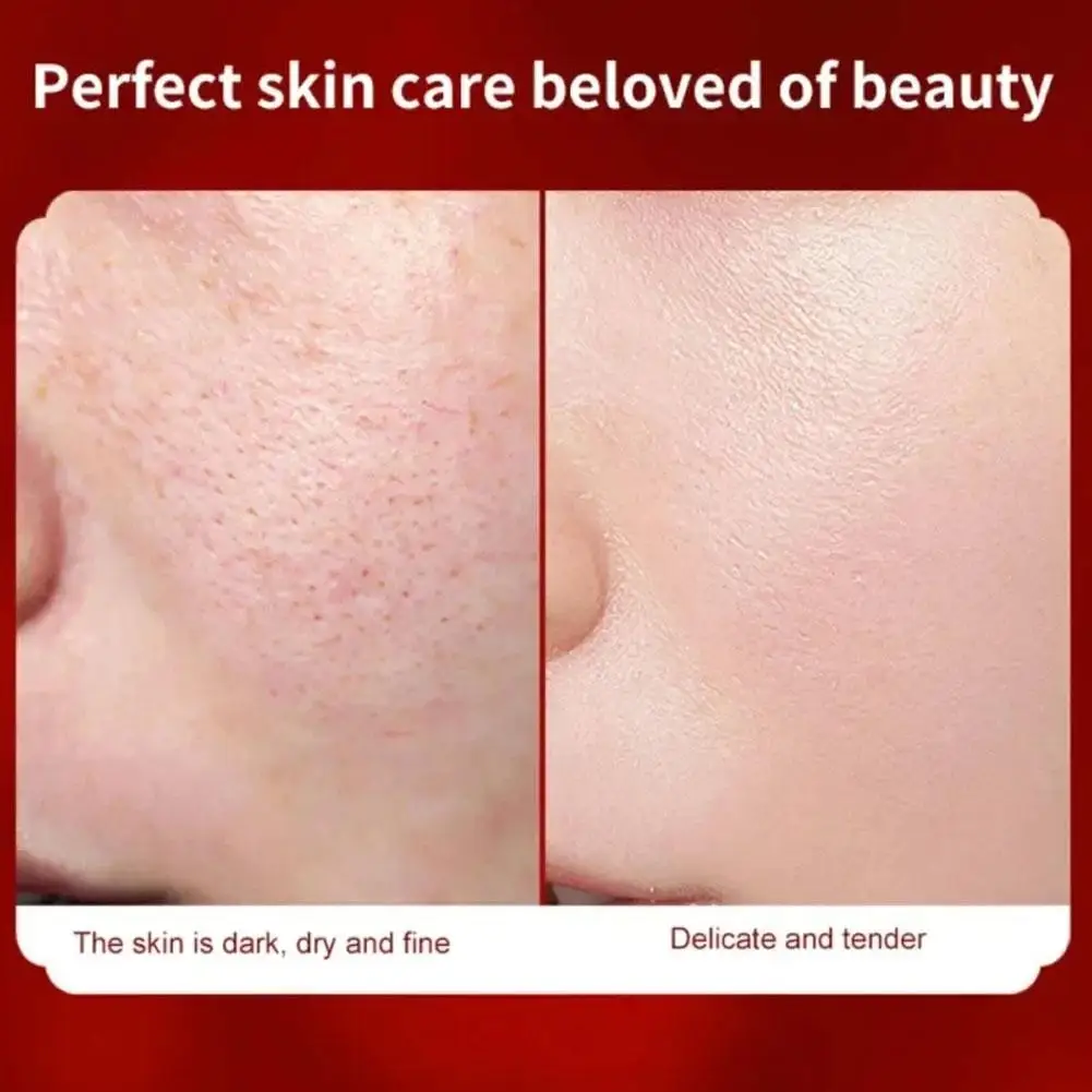 Retinol Dragon Blood Facial Cream Moisturize Repair Whiten Concealer Fine Lines Pores Acne Brighten Skin Tone Korean Cosmetics
