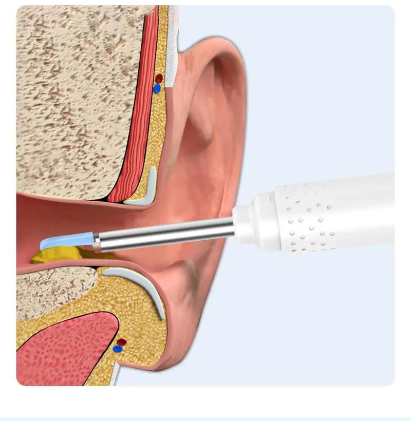 2026 New Upgrade Visual Ear Wax Cleaner Camera Safe Earwax Removal Endoscope with 5M Camera Ear Cleaning Tools Ear Care