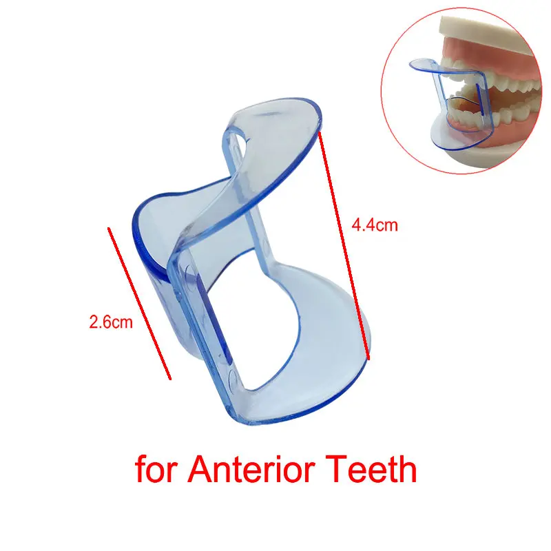 Dental Mouth Opener Orthodontic Lip Cheek Retractor Mouth Spreader Autoclavable Dental Cheek Retractor
