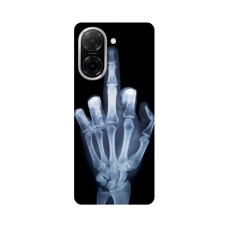 For Redmi A5 NFC Case Football Soft Silicone Back Case For Xiaomi Redmi A5 NFC (173,45mm) Phone Cover Redmi A5NFC etui Fundas