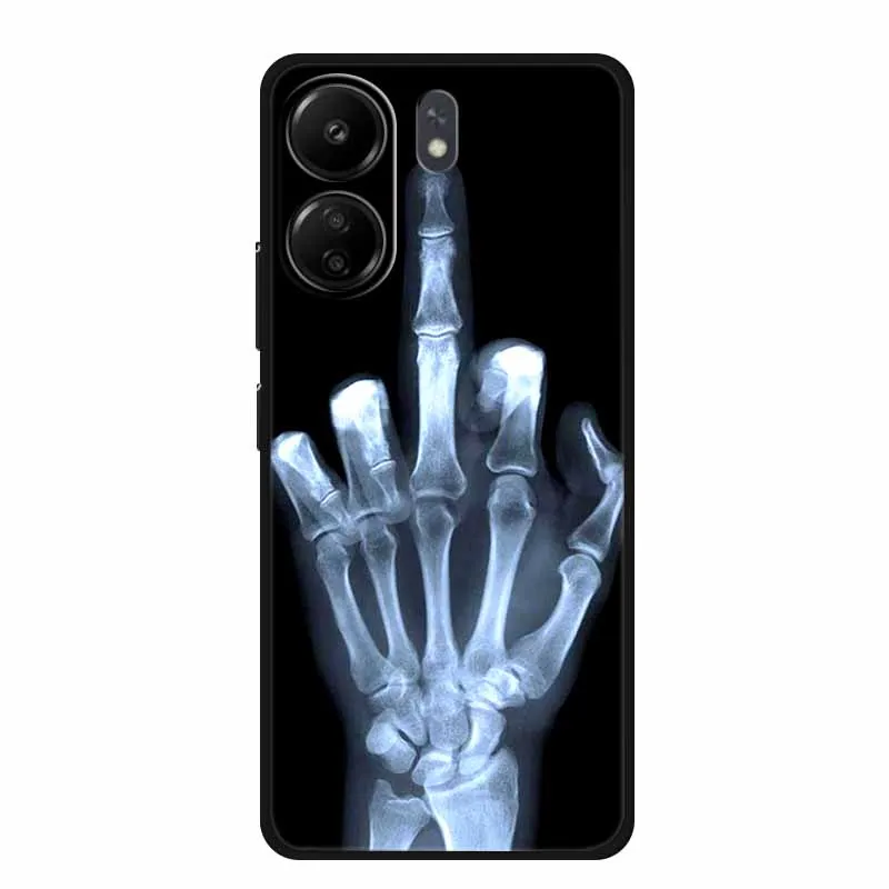 For Redmi 13C 4G Case Fashion Soft Silicone TPU Phone Cases For Xiaomi Redmi13C 13 C Back Cover Coque Fundas Protector Shell