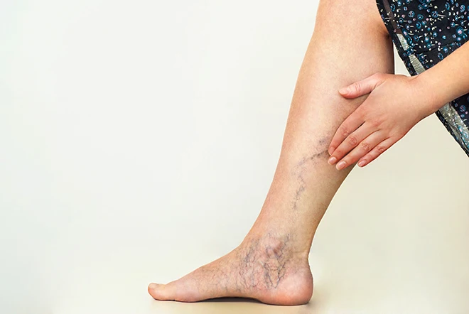 20-30 MmHg Compression Socks Women Men Firm Support Stockings Varicose Veins Hosiery for Edema, Swelling, Pregnancy, Recovery