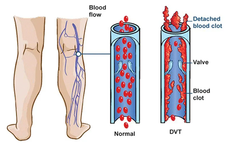 40-50 MmHg Compression Socks Men-Best Support Sock for Medical,Varicose Veins,Edema,Shin Splints,DVT,Anti-Fatigue,Blood Clots
