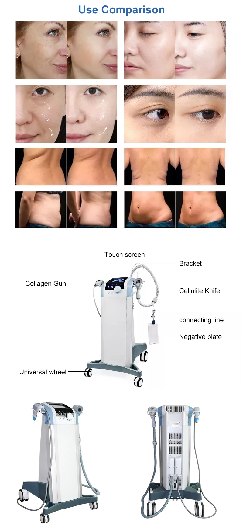 2026 Newest SLyric Fat Burner Fat Remover Face Lifting Skin Tightening Slimming Body Contouring Cellulite Professional