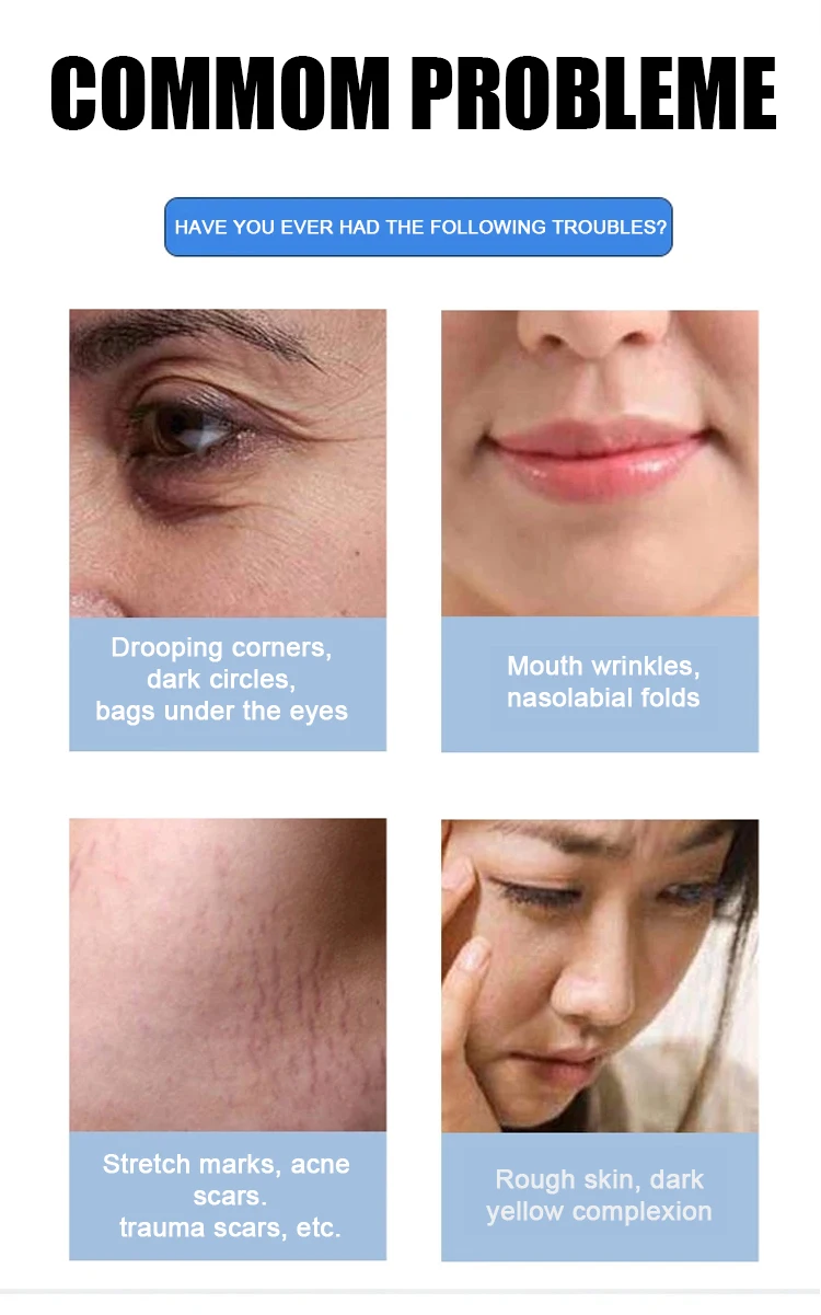 80W Fractional CO2 Laser Machine 10600nm Professional CO2 Laser Beauty Machine for Scar Removal Skin Tightening Acne Treatment