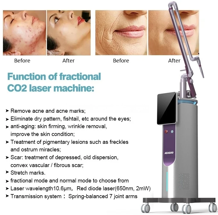 2026 Fractional CO2 Laser Machine 10600nm Professional CO2 Laser Beauty Machine for Scar Removal Skin Tightening Acne Treatment