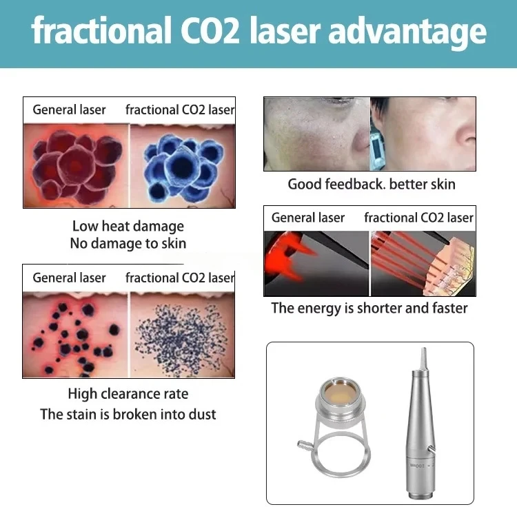 2026 Fractional CO2 Laser Machine 10600nm Professional CO2 Laser Beauty Machine for Scar Removal Skin Tightening Acne Treatment