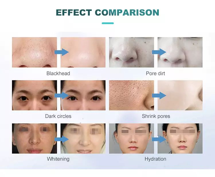 Hydrofacial 7 In 1 Professional Portable Dermabrasion Smart Ice Blue Facial Treatment Machine Latest Skin Rejuvenation Device.