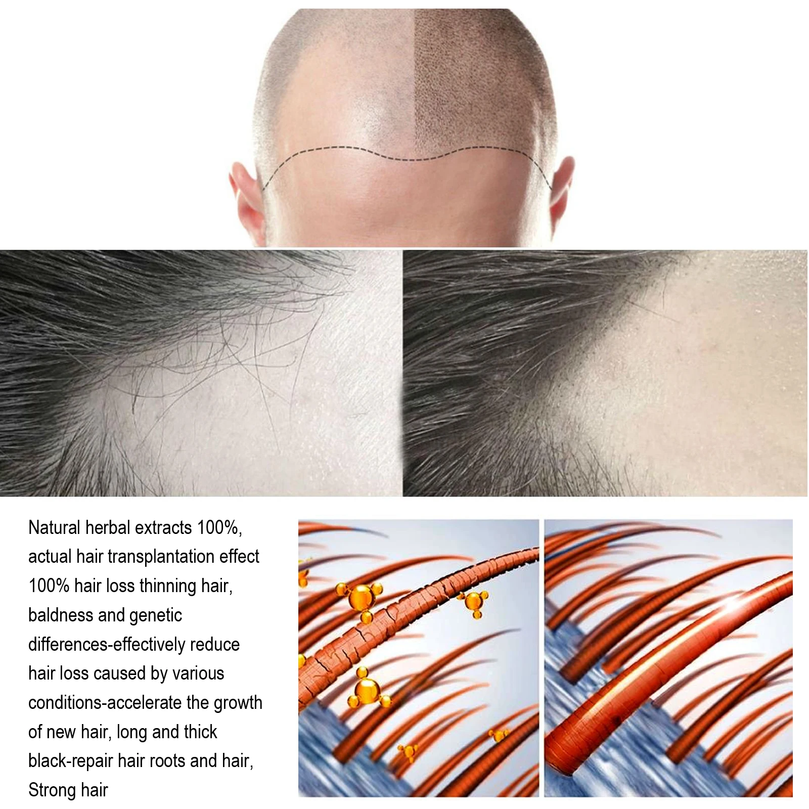 Hair Growth Serum 7 Days Fast Regrowth Essential Capsule Anti Hair loss Baldness Repair Damaged Scalp Treatment For Women Men