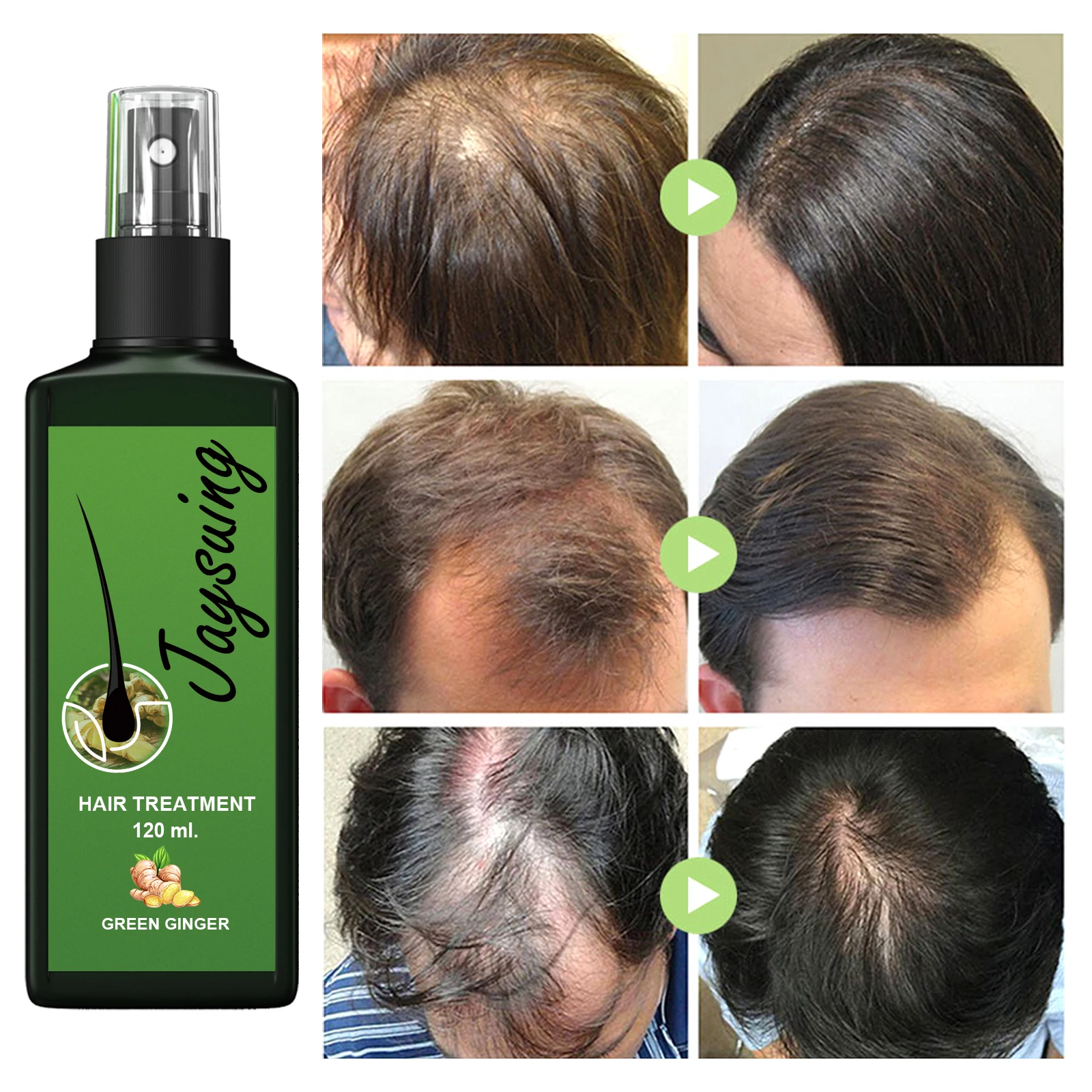 Hair Growth Serum 7 Days Fast Regrowth Essential Capsule Anti Hair loss Baldness Repair Damaged Scalp Treatment For Women Men