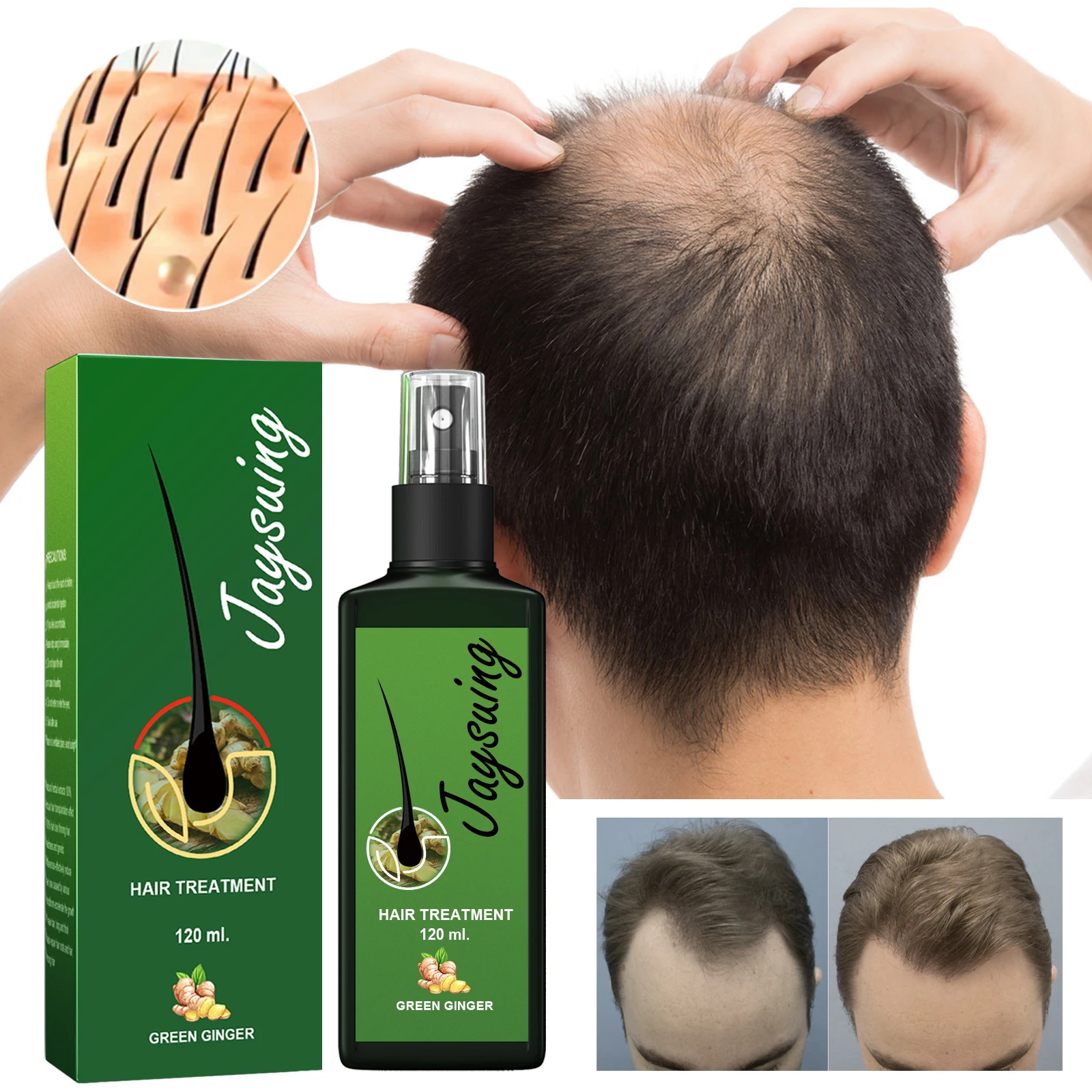 Hair Growth Serum 7 Days Fast Regrowth Essential Capsule Anti Hair loss Baldness Repair Damaged Scalp Treatment For Women Men