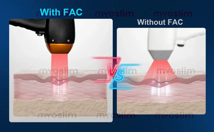 Diode Laser Hair Removal Device810 5000W 16Bars Upgraded Version Painless Permanent Hair Removal Three Wavelength Cooling System