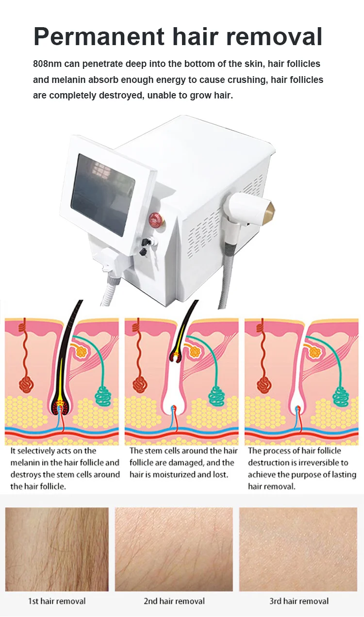 4000W Titanium Diode Laser Epilator Permanent Hair Removal Professional Laser 3 Wavelength 755 808 1064nm Painless Hair Removal
