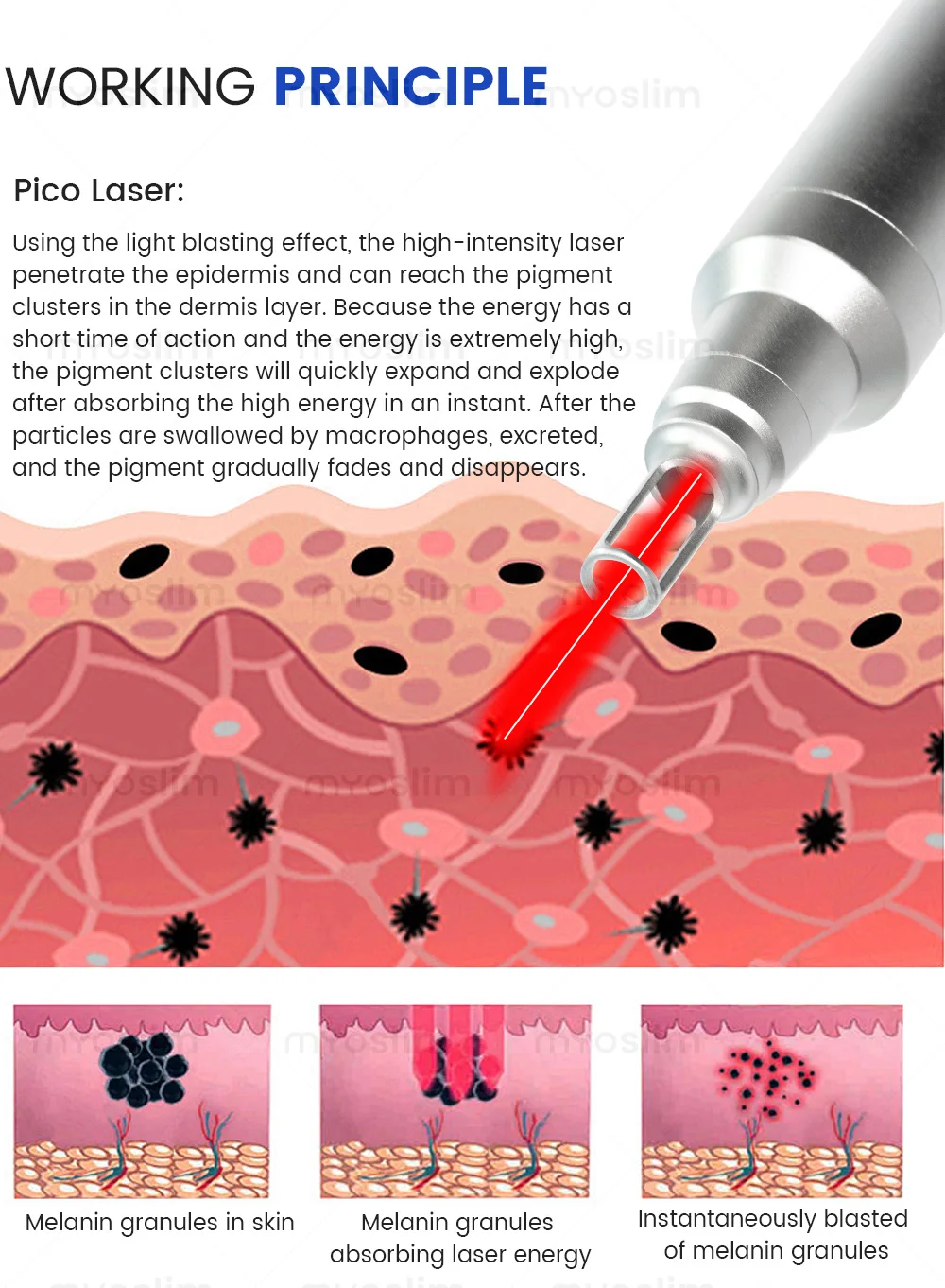 FAC 5000W 2 IN 1 Professional 4 Wave 808 Diode Laser Permanent Painless Hair Removal Picosecond Laser Tattoo Removal Machine
