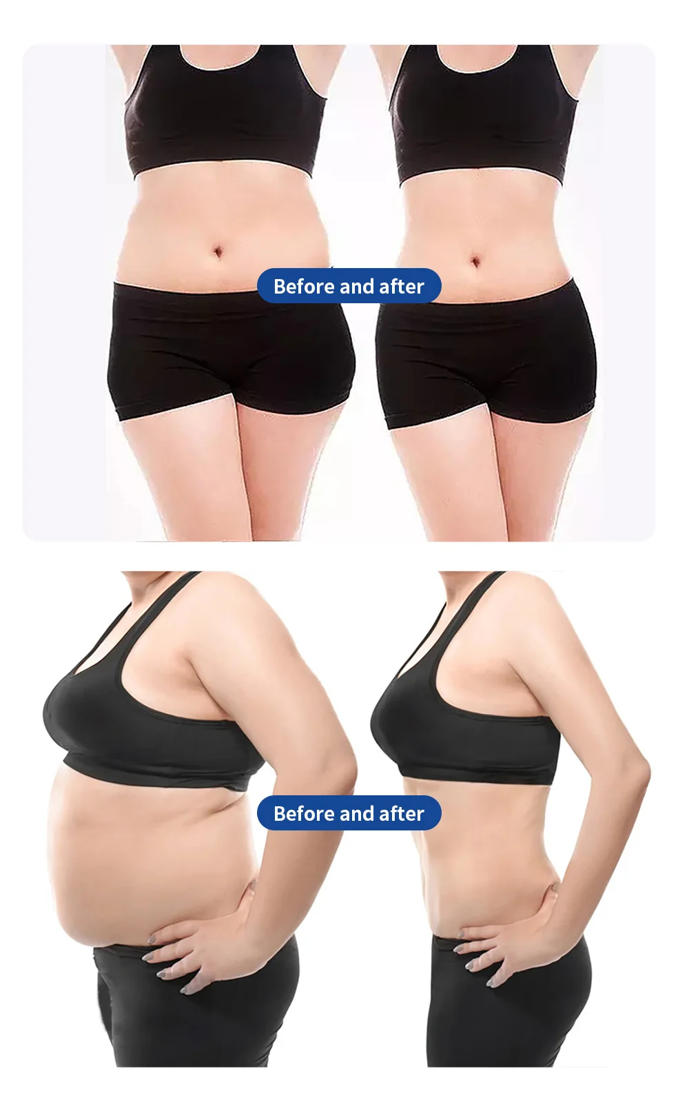 Myoslim Machine Professional EMS Body Muscle Stimulation Carving EMS Slimming Machine EMS Pro NEO RF Machine In Sculpt