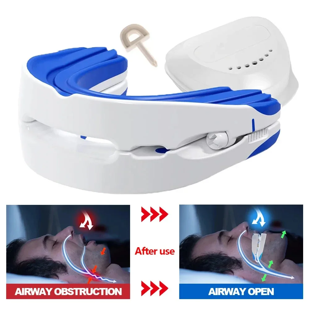 Anti-snoring Mouthpiece Anti-snoring Device Nighttime Teeth Guard Adjustable Sleeping Mouthguard for Bruxism