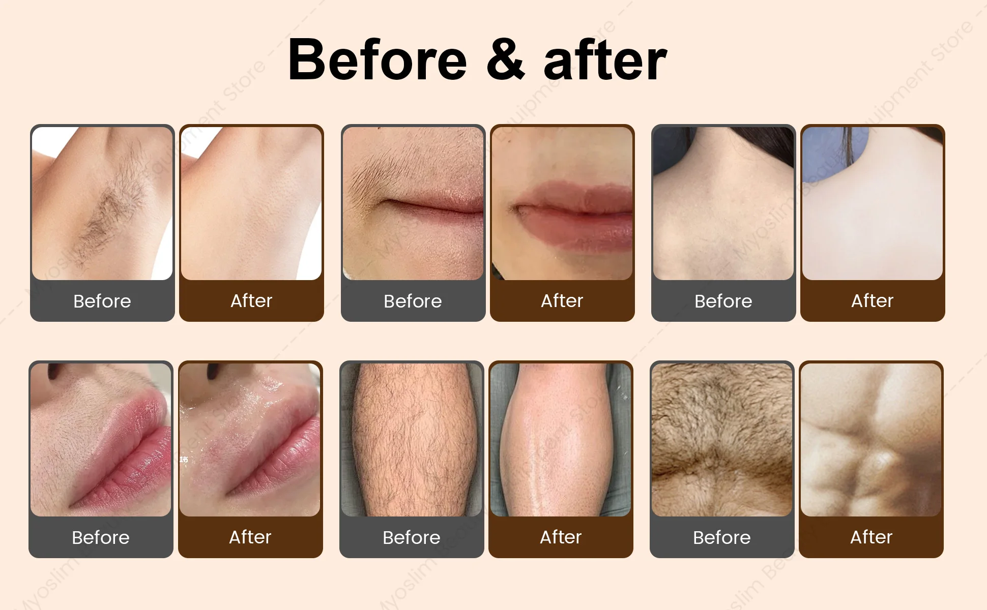 Latest Ice Titanium 808nm Diode  Hair Removal Machine with 3-wavelength Alexander  for Painless Permanent Hair Re