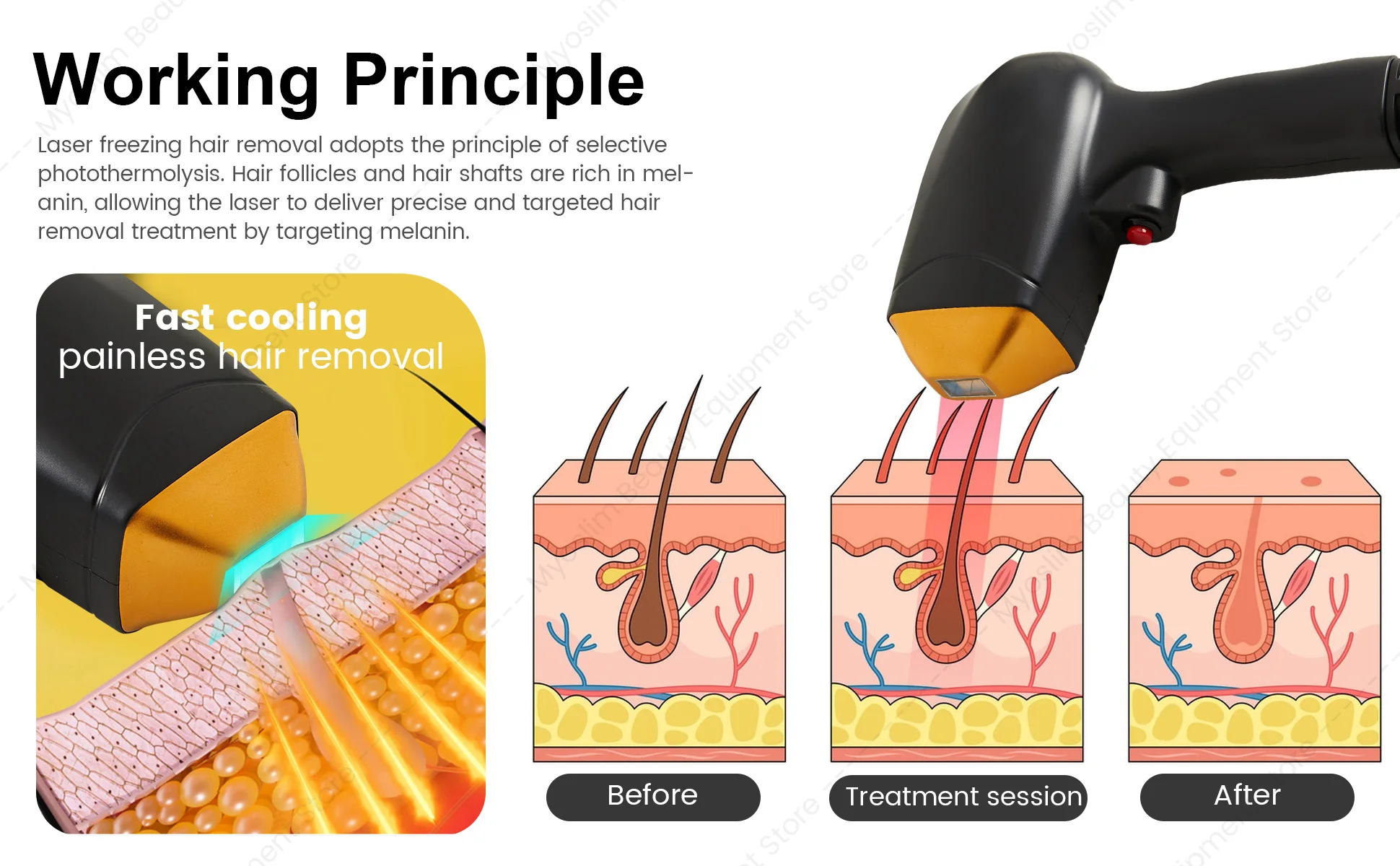 Latest Ice Titanium 808nm Diode  Hair Removal Machine with 3-wavelength Alexander  for Painless Permanent Hair Re