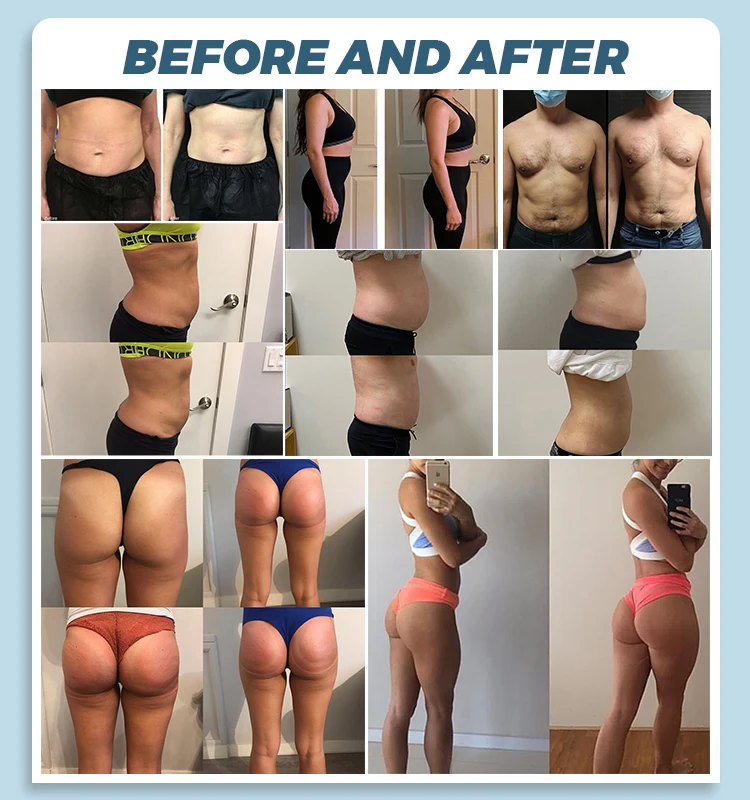 MYOslim RF Sculpt Machine EMS Body Sculpting Weight Loss Massager Device 15 Electromagnetic Fat Slimming Muscle Stimulation