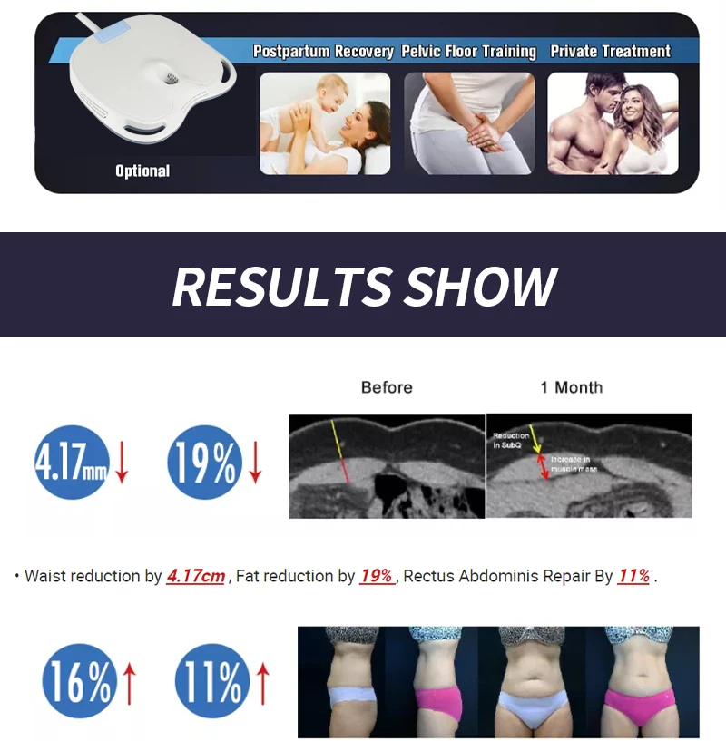 MYOslim RF Sculpt Machine EMS Body Sculpting Weight Loss Massager Device 15 Electromagnetic Fat Slimming Muscle Stimulation