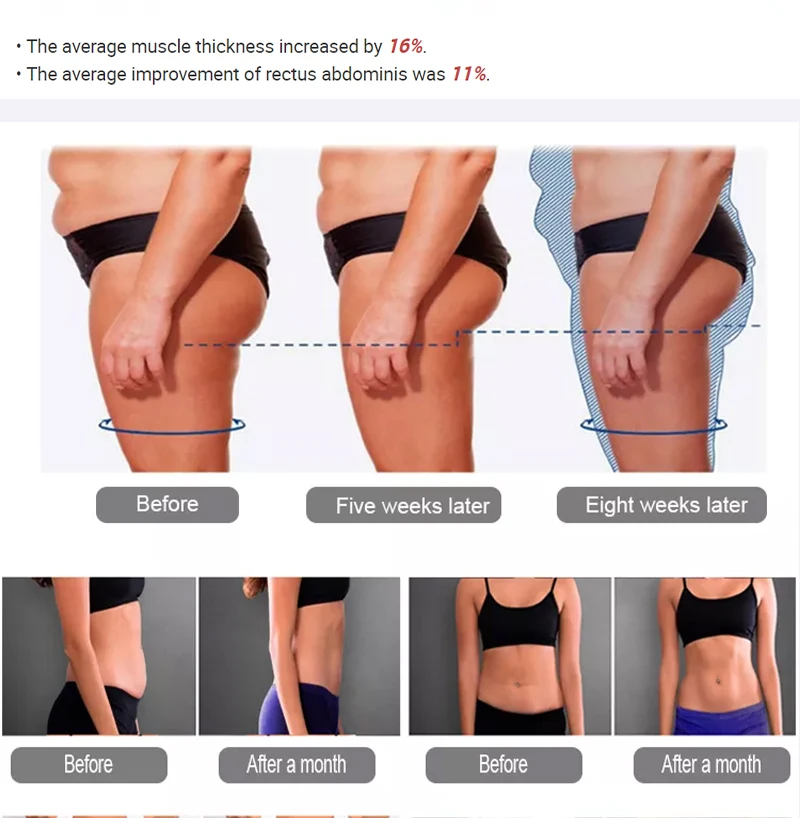 MYOslim RF Sculpt Machine EMS Body Sculpting Weight Loss Massager Device 15 Electromagnetic Fat Slimming Muscle Stimulation