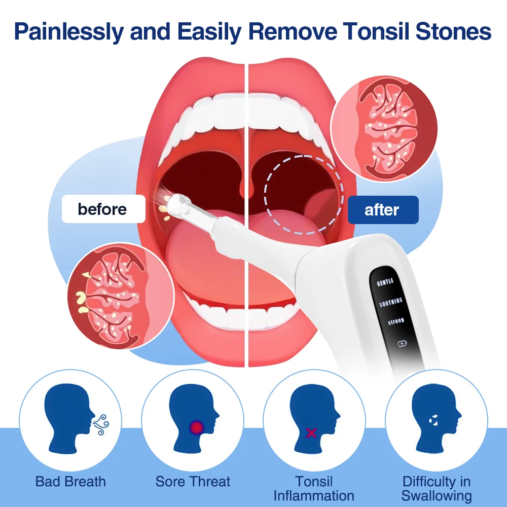 Electric Tonsil Stone Remover Kit with 3 Suction Modes UV Disinfection Oral Care Mouth Cleaning Tool for Tonsil Stones