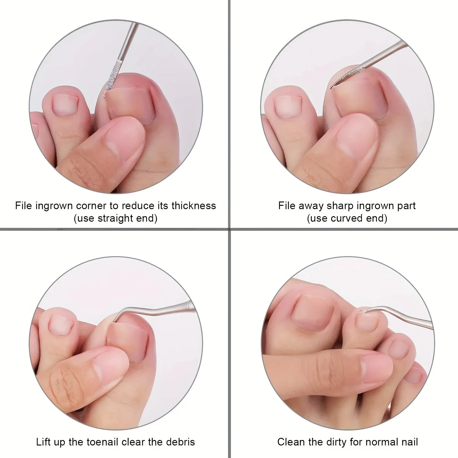3pcs Set Professional Endogenous Toenail Suit: Stainless Steel File with Lifter and Storage Box-No Odor, Foot and Nail Care