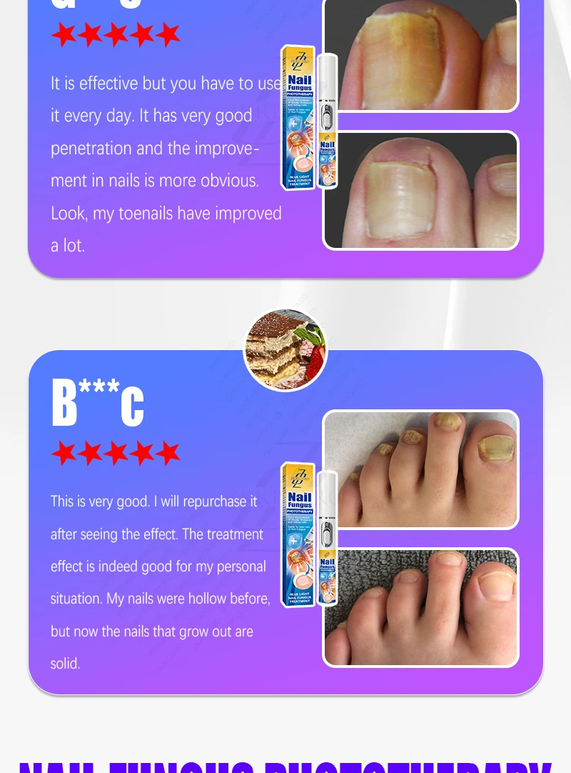 Advanced Laser Pen for Healthy Nail Growth