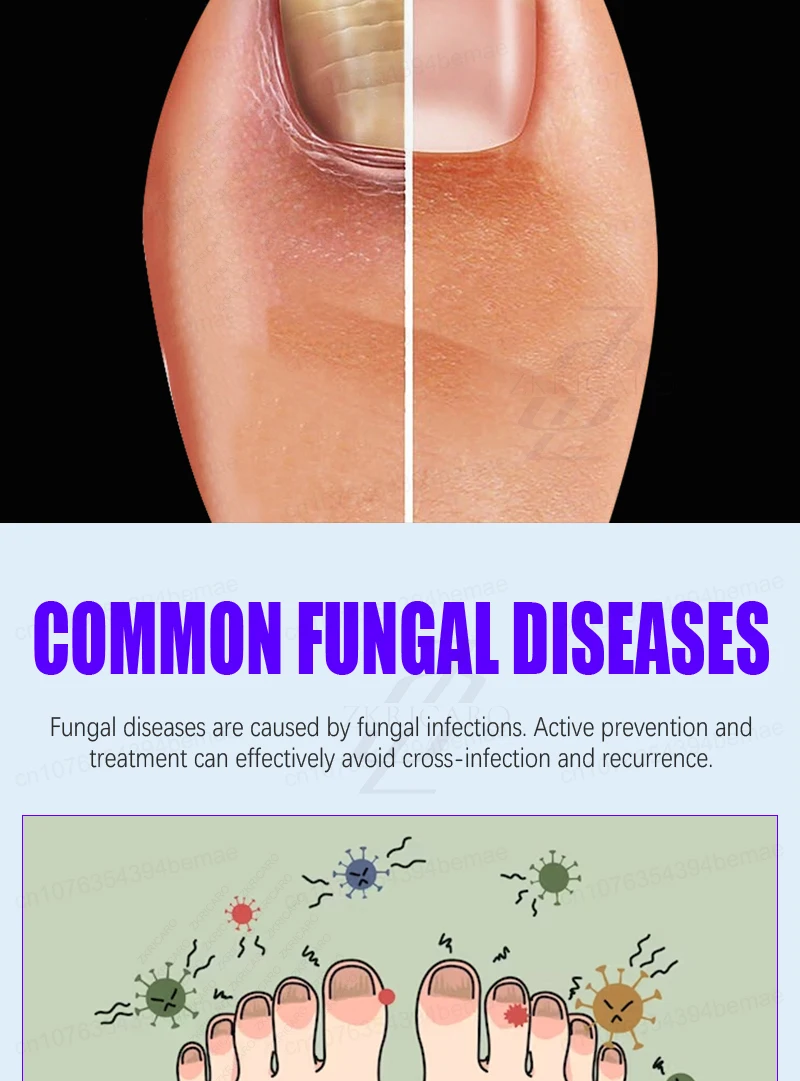 Advanced Laser Pen for Healthy Nail Growth