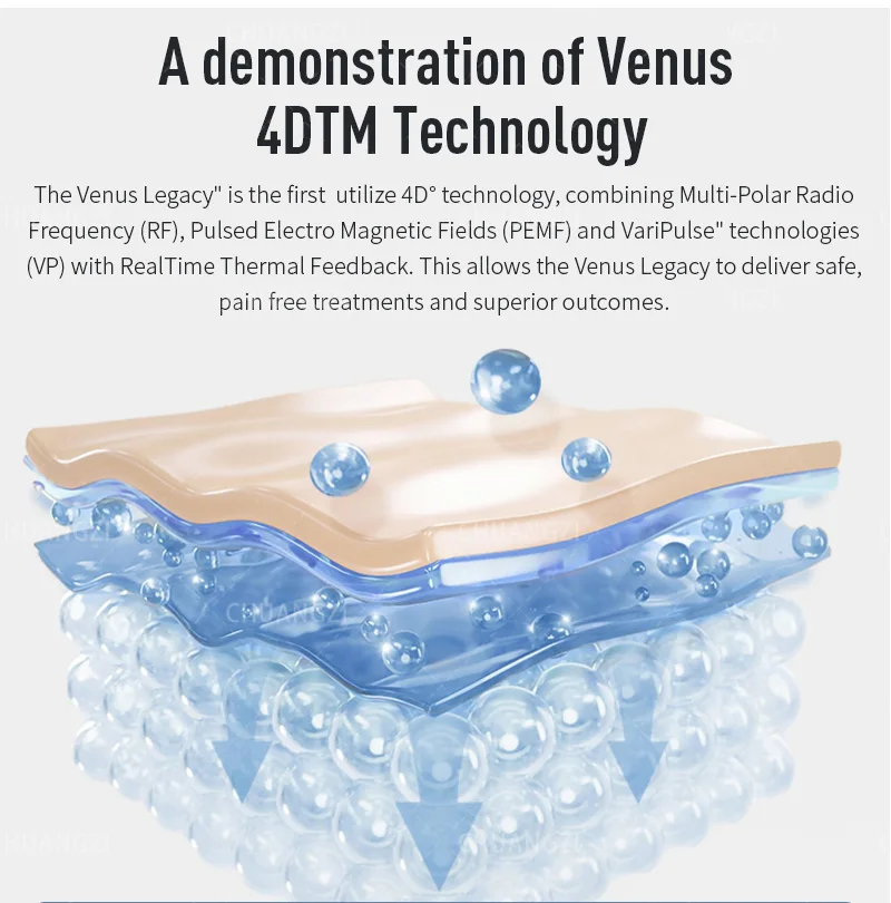 Venus Legacy Cellulite Treatment Machine Vacuum Slimming Cellulite Removal Vacuum Legacy Skin Lifting SPA Device