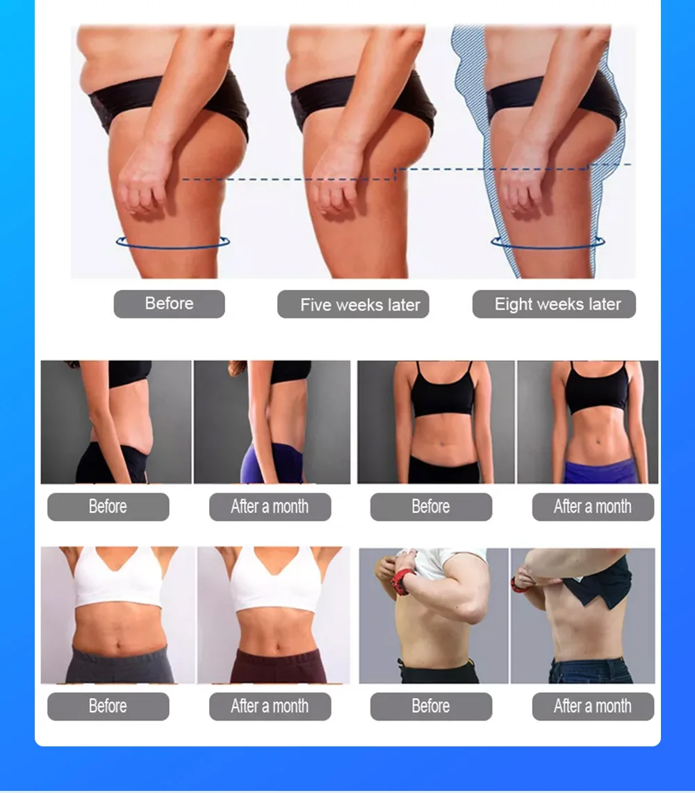 Myoslim Neo Muscle Stimulate Fat Removal EMS Body Slimming Butt Build Sculpt Machine Weight Lose For Salon