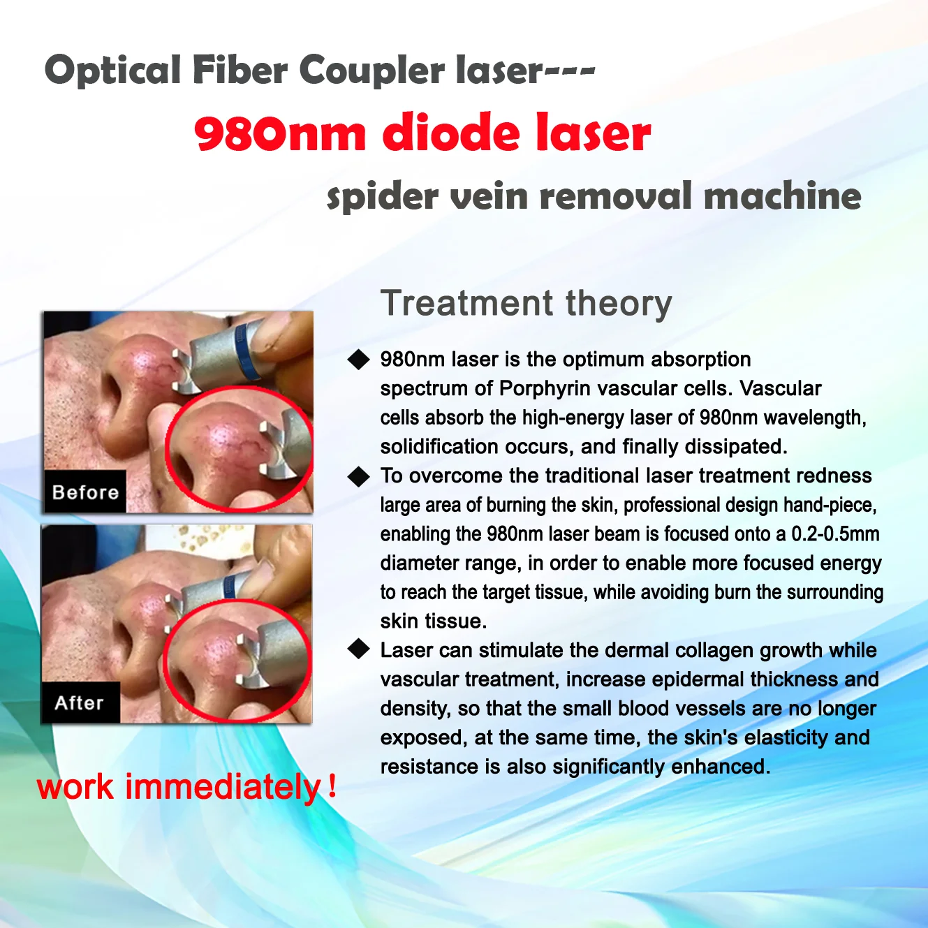 BEST 5 in 1 980nm Diode Laser Vascular Removal Machine Remove Spider Veins 980 Diode Laser Blood Vessels Removal Nail Fungus