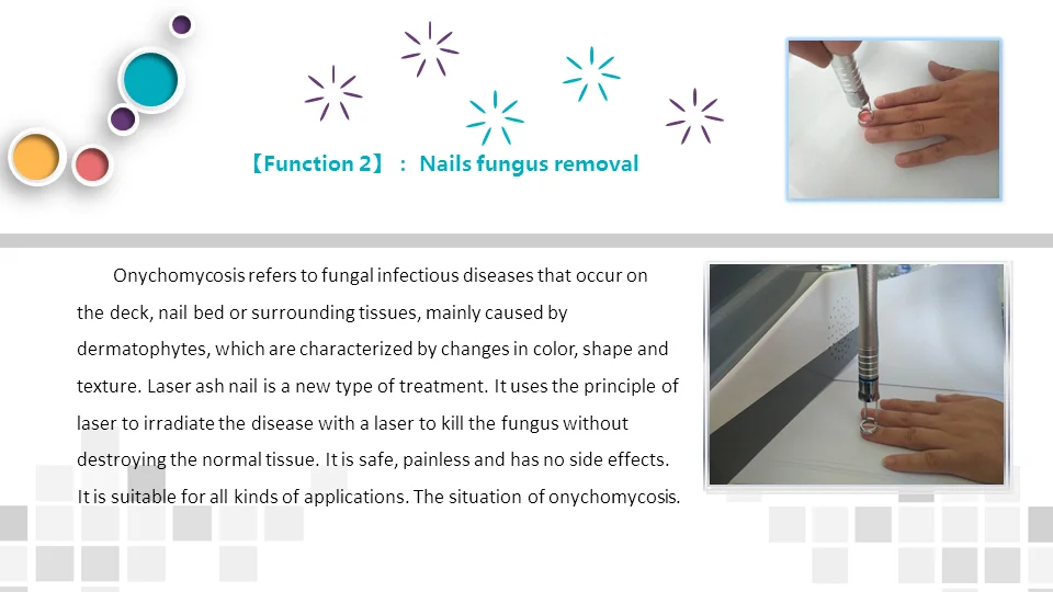 BEST 5 in 1 980nm Diode Laser Vascular Removal Machine Remove Spider Veins 980 Diode Laser Blood Vessels Removal Nail Fungus