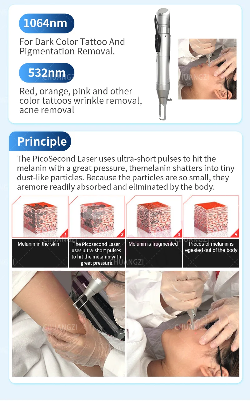 CO2 Laser Machine for Skin Carbon Peel Professional Fractional Laser Machine Portable CO2 Fractional Laser Machine Skin Firm