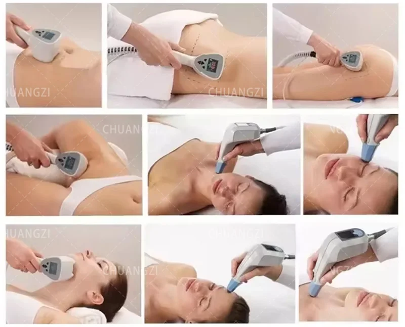 Portable RF Equipment Slimming Machine Ultrasonic Cellulite Wrinkle Removal Face Lift 2 Handles Ultra 360 Fat Reducing Machine