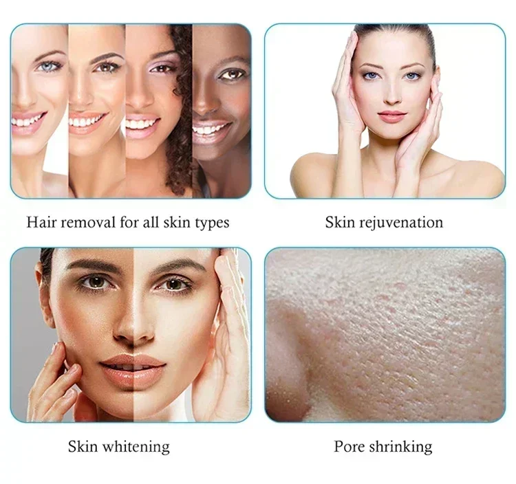 Professional 808nm Diode Laser 3000w High Power 755 808 1064nm Laser Painless Freezing Point Eepilation for Women