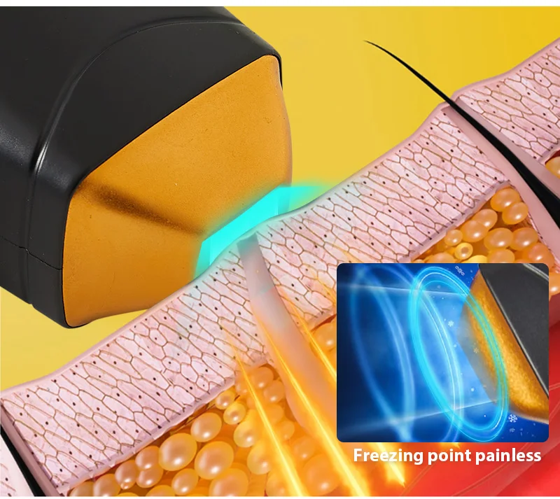 Professional Laser Epilator Ice Titanium Permanent Hair Removal 3 Wavelengths Diode Laser Remove Hair Machine for Salon