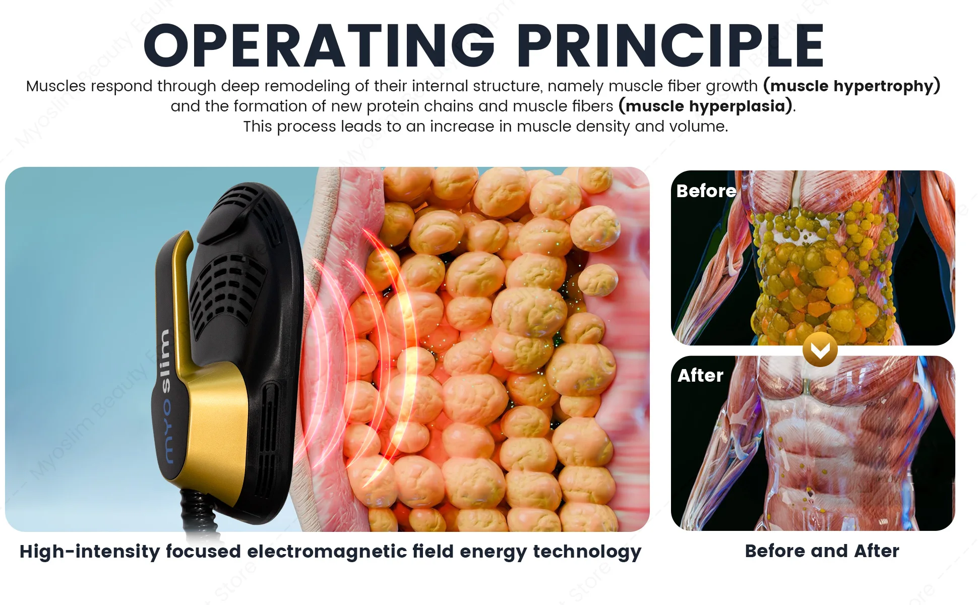 EMSZERO Nova Professional PRO ULTRA Machine Body Sculpting Machie Weight Loss Muscle Stimulation