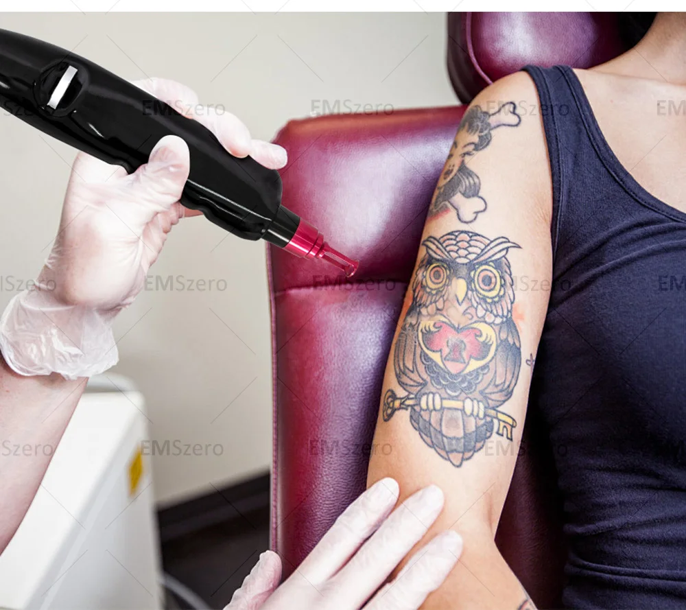 Soprano Titanium Hair Removal Professional 4-In-1 Diode Laser Pico LPL Nd Yag Picosecond Laser Opt Hair Removal Tattoo Removal