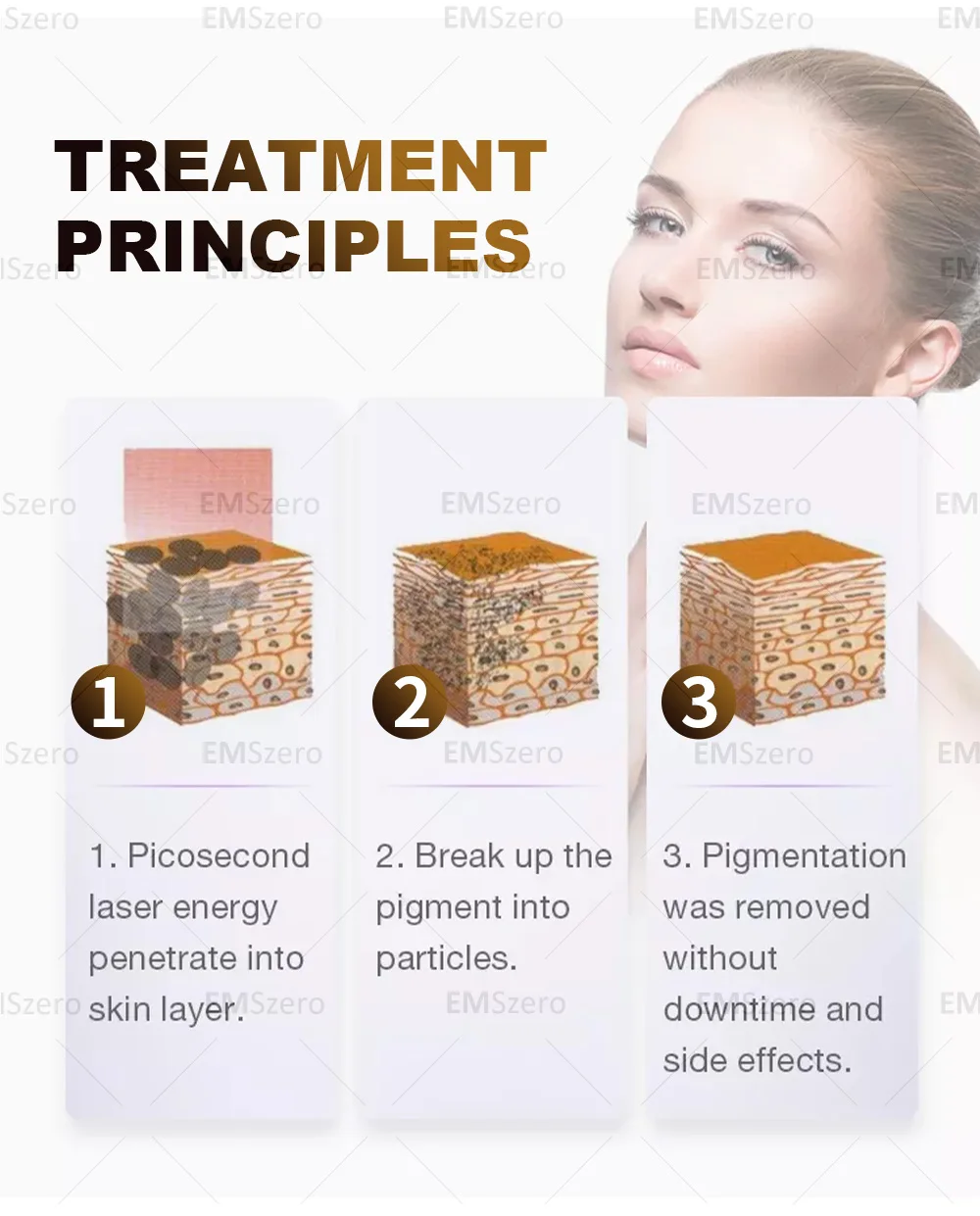 Soprano Titanium Hair Removal Professional 4-In-1 Diode Laser Pico LPL Nd Yag Picosecond Laser Opt Hair Removal Tattoo Removal