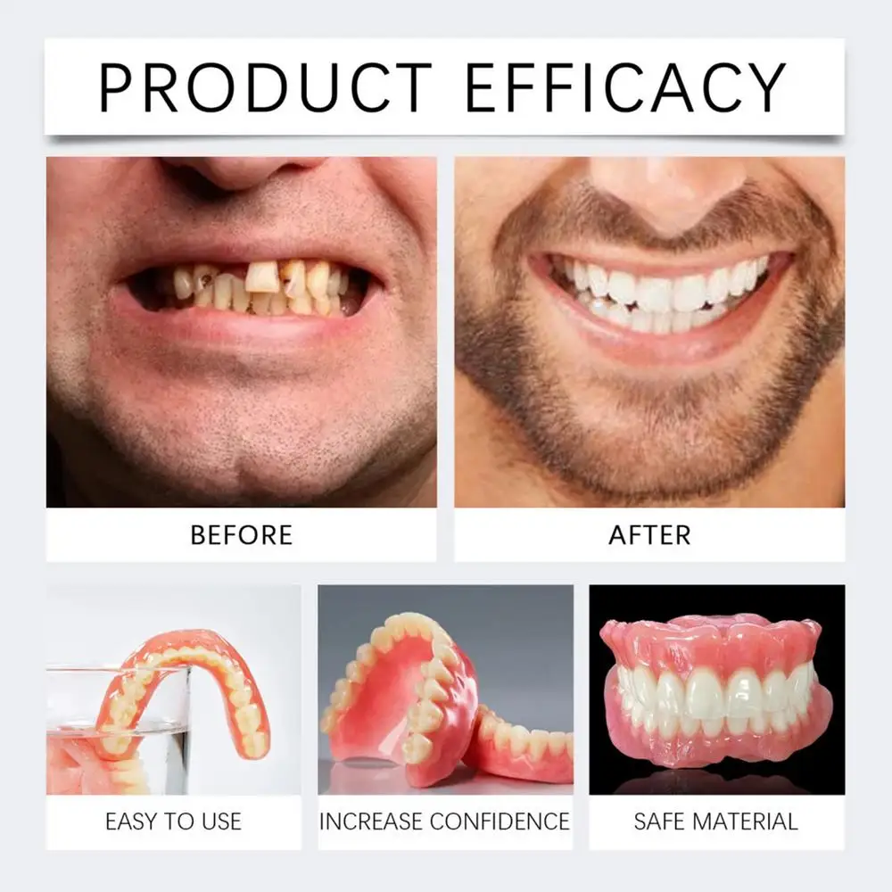 Denture Set False Teeth Top And Bottom Denture Solution Realistic False Teeth Professional Temporary Teeth Kit For Lovers
