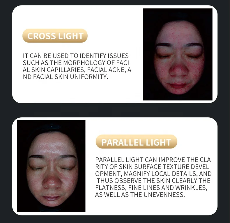 Upgraded X5 3D Ai Skin Image Analyzer High Definition Pixels Whole Facial Scanning Multi Spectrum Moisture Scalp Detection