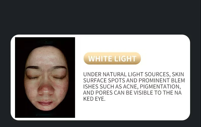 Upgraded X5 3D Ai Skin Image Analyzer High Definition Pixels Whole Facial Scanning Multi Spectrum Moisture Scalp Detection